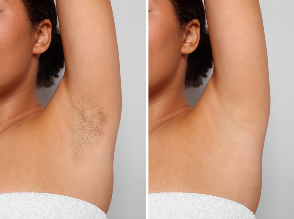 Reveal Silky Smooth Skin and Boost Confidence